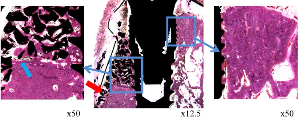Fig. 11. Histological images of the 12 week ErhBMP-2 group 