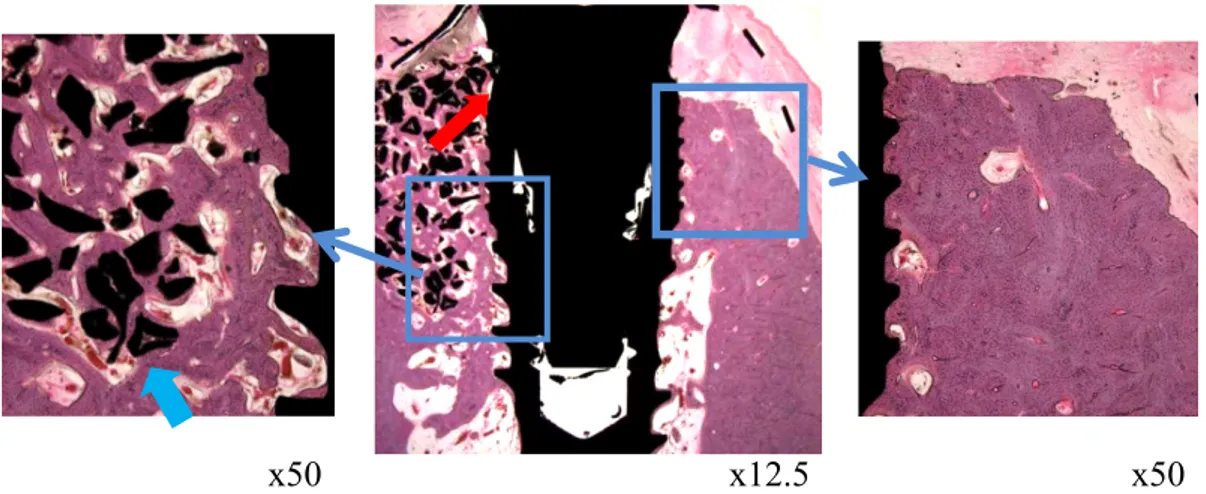 Fig. 12. Histological images of the 12 week ErhBMP-2 / EGCG group 