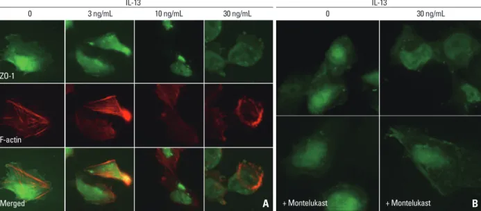 Fig. 1. Distributional changes in ZO-1 by IL-13 in human podocytes. ZO-1 was distributed at the peripheral cell membrane and colocalized with  β-catenin and  actin filament at cell-to-cell contact junctions