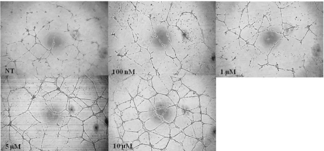 Fig.  4.  Vimentin  protein  transduction  promotes  tube  formation  of  endothelial cells