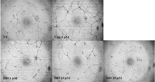 Fig.  6.  PKA  inhibitor  suppresses  vimentin-induced  endothelial  cell  tube  formation