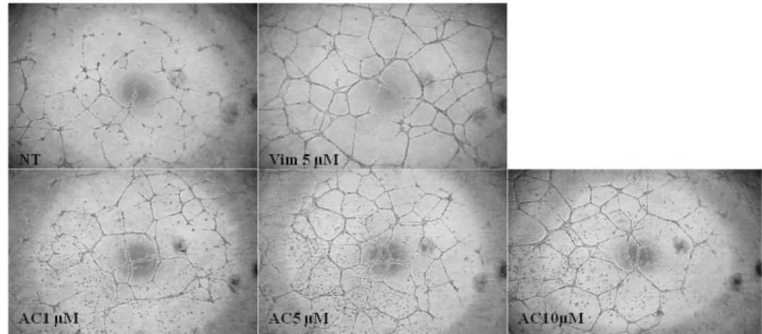 Fig.  8.  Adenylate  cyclase  inhibitor  did  not  affect  vimentin-induced  tube  formation
