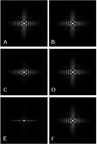 Fig. 7. The images are transformed into frequency domain by  2D FFT. (A) Static image without motion (B) Summed dynamic image without motion (C) Before motion correction (minimal  motion) (D) After motion correction (minimal motion) (E)  Before motion corr