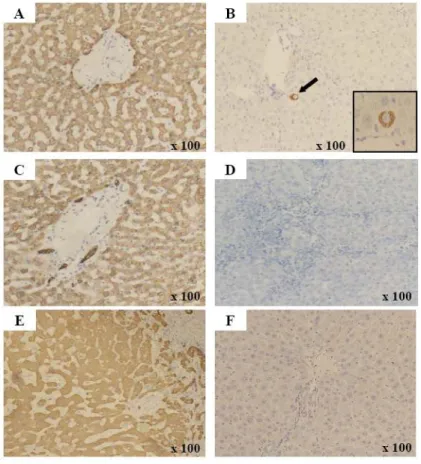 Figure  5.  Immunohistochemical  detection  of  human  hepatocytes.  Immunohistochemistry  on  human  liver  sections  with  HepPar1  (A),   anti-CK18  (C),  and  anti-CK8  (E)  that  exclusively  detect  human,  not  mouse  or  rat,  hepatocytes