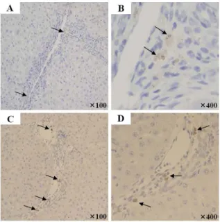 Figure  6.  Immunohistochemical  detection  of  human  cells.  Infused  CBMSCs  were  detected  by  immunohistochemical  stain  for  anti-human  nuclei  (A,  B)  and  anti-human mitochondria (C, D) in the region of fibrous septal, perivascular, and  peripo