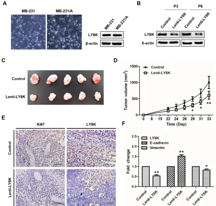 Figure 2: Tumorigenesis effect of LY6K in vivo.  A. Cellular morphology of mouse adapted MB-231 cells and protein expression  level of LY6K