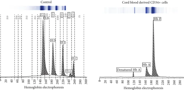 Figure 5: Electrophoretic determination of main hemoglobin subtypes in differentiated mPB and CB cells