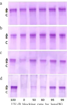 Fig. 4. The effect of lenses on the denaturation of catalase induced by UV-B.