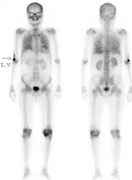 Fig. 2. LAO image at chest