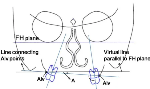 Figure  2.  Measurement  of  maxillary  canting  at  each  tooth.  Maxillary  canting  was  measured as the angle of (A°) between the FH plane and the line connecting Alv of both  sides