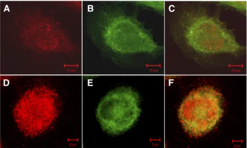 FIGURE 3. Subcellular localization of HKII in SNU449 and SNU449-HKII cells. Confocal microscopy shows markedly increased HKII expression after  trans-fection (SNU449-HKII), and large  pro-portion of HKIIs are mitochondrially associated