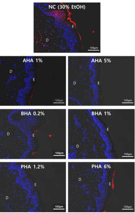 Figure 4. Effect of hydroxyacids on the skin penetration of rhodamine B Permeability of rhoda-