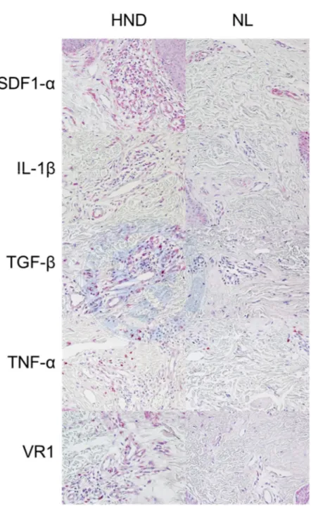Figure 3. Results of immunohistochemical stain at (A) original  magnification x 200 and (B) original magnification x 400