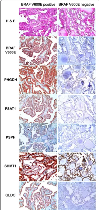 Fig. 3  Expression of serine/glycine metabolism‑related proteins 