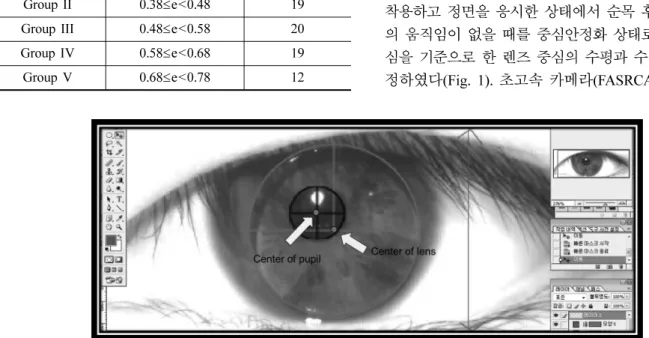Table 1. Corneal eccentricity of Koreans in their twenties.