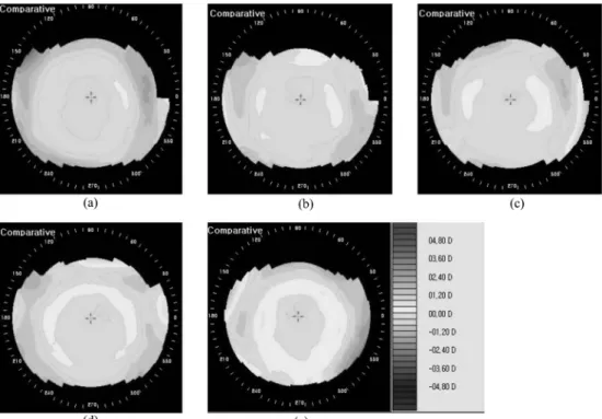 Fig. 5. Ortho-k-like topography(difference display map) resulting from everted silicone hydrogel lens wear
