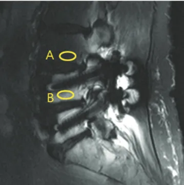Fig. 1.  Magnetic resonance (MR) image indicating the 