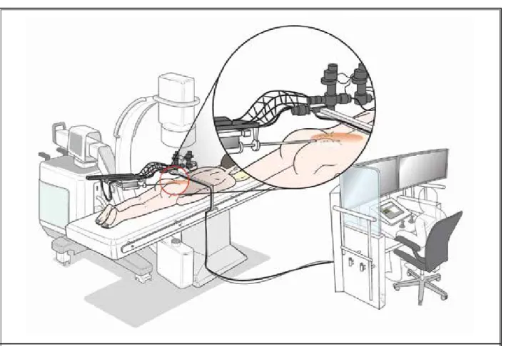 Fig. 3. A schematic diagram of  the robot-assisted epiduroscopy system. A patient is lying on a surgical table onto which the robotic 