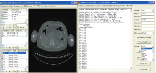 Fig. 3. Capture screen of Conquest DICOM Server. A database browser and slice viewer integrated in the PACS system with options for: 
