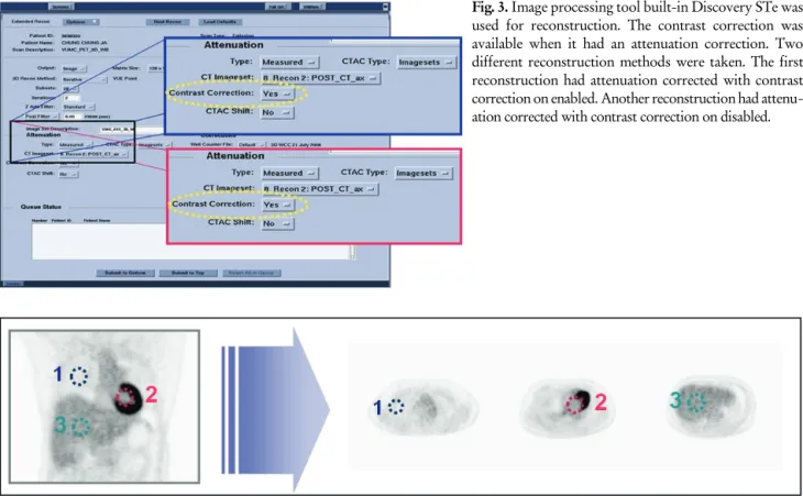 Fig. 3. Image processing tool built-in Discovery STe was  used for reconstruction. The contrast correction was  available when it had an attenuation correction