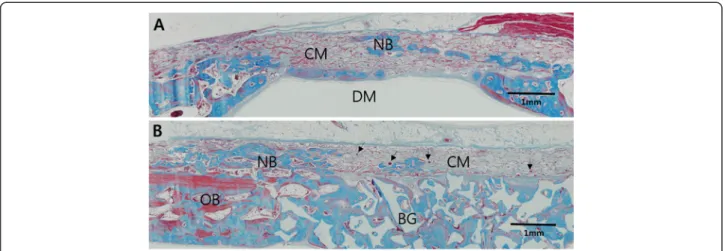 Fig. 5 Higher magnification view of the defect sites at 8 weeks, Trichrome staining. (a) Histologic view of CM group showing islets of new bone (NB) integrated within the CM at the middle of the defect