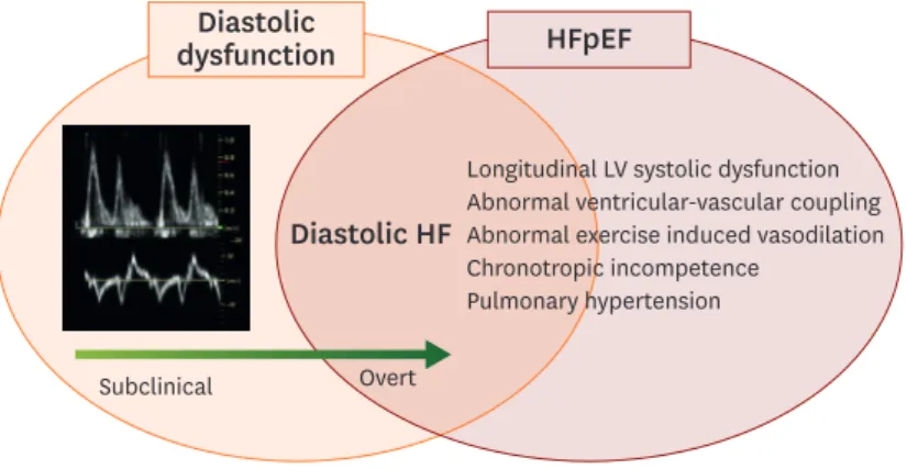 Figure 1.  Basic concepts of diastolic HF and HFpEF. 