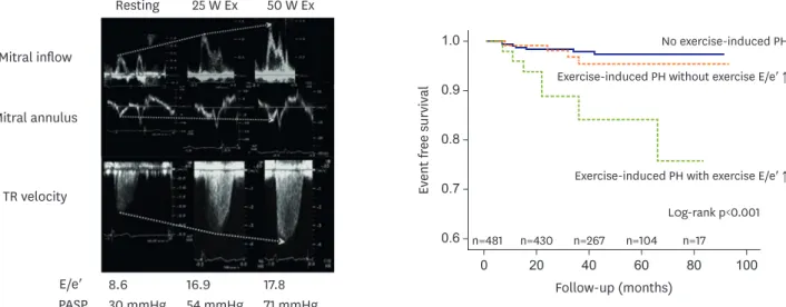 Figure 4.  Exercise-induced elevation of left ventricular filling pressure and exercise-induced PH detected by diastolic stress echocardiography