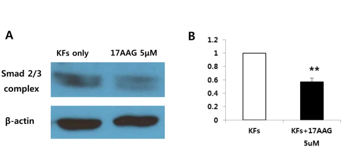 Figure 3. Immunoblotanalysis of Smad 2/3 complex expression in KFs. (A) 17AAG (5 μM)decreasedthe  expression of Smad 2/3 complex protein in KFs compared with non-treated KFs