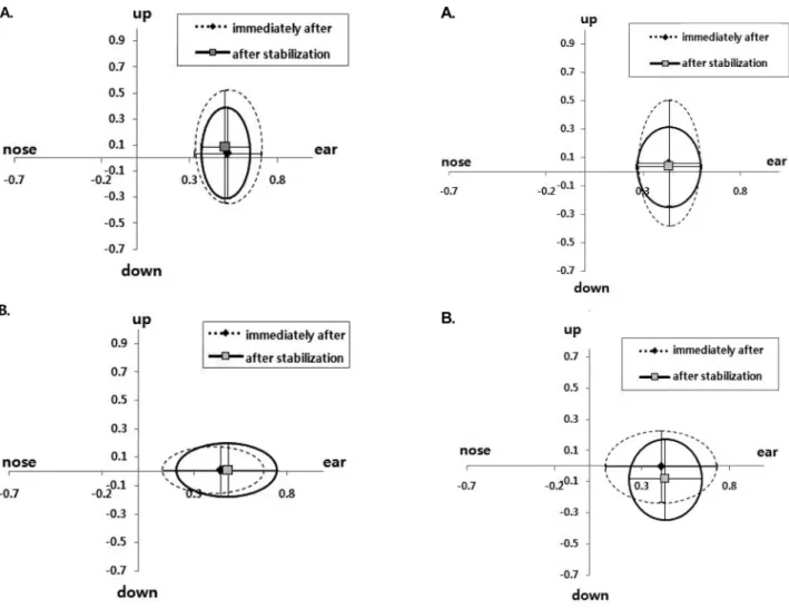 Fig. 10. Lens centration in normal and dry eyes with steep fitting. 