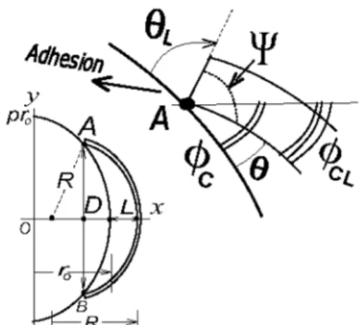 Fig. 4. Configuration of the lacrimal edge shape between cornea and tight fitted lens