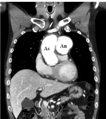 Figure 3. Chest computed tomography with contrast showed a