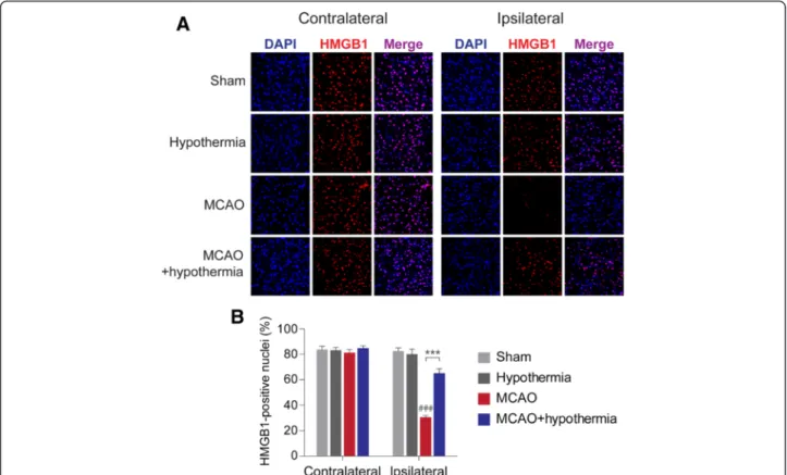 Fig. 2 Hypothermia restores HMGB1 immunoreactivity in post-ischemic MCAO rat brains. a, Representative immunohistochemistry results from MCAO-treated rat brains in the absence or presence of hypothermia