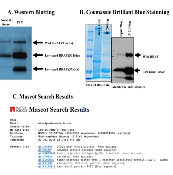 Figure  3.  Detection  of  splicing  variants  of  B-RAF;  Western  Blotting  (A),    Coomassie  Brilliant  Blue  Stanining  (B)  and  Mascot  Search  Results  (C) 