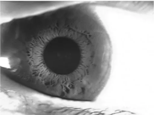 Fig. 12. An image which is photographed by the previous system.