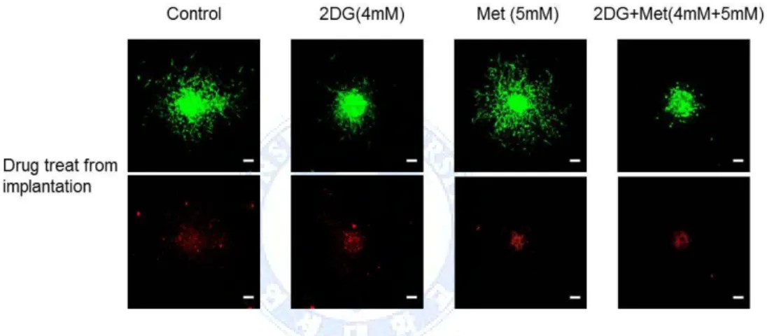 Fig. 8. Viability of glioblastoma (GBM) tumorsphere (TS) in collagen matrix  with drugs, Red fluorescence indicating dead cells is mainly localized in the  core of the spheroids