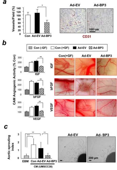 Figure 2. IGFBP-3 suppresses tumor-associated or growth factor–induced angiogenesis in vivo and in vitro.
