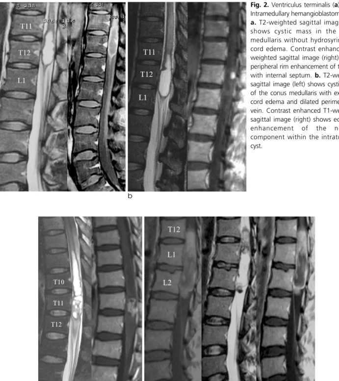 Fig. 2. Ventriculus terminalis (a) versus
