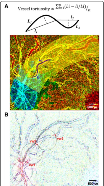Fig. 1 Illustration of the subdivision used to estimate vessel tortuosity (a) and vascular width (b)