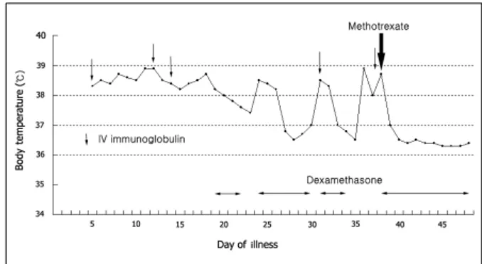 Fig. 4. Body temperature in a 7-year-old boy with refrac- refrac-tory Kawasaki disease