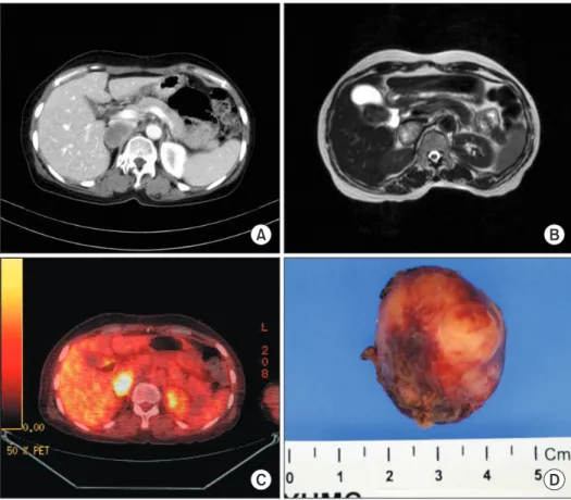 Fig. 2.  Preoperative image 