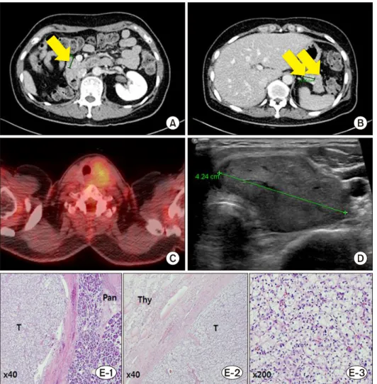 Fig. 1. Preoperative computed 