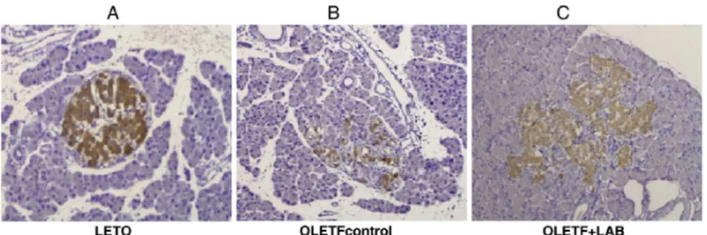Figure 6.  Effects of LAB on pancreas histology. Pancreatic islets masses  were  stained  by  insulin  immunohistochemistry  in  LETO  (A),  untreated  (B) and LAB-treated OLETF rats (C) at 52 weeks of age