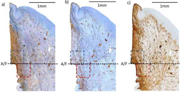 Figure 4. Immunohistochemical (IHC) stained histological slides of different types of primary