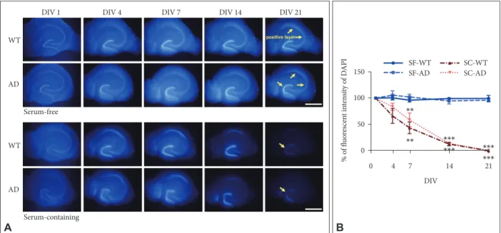 Figure 2. Effects of age and genotype on maintenance of hippocampal structure in long-term OHSC