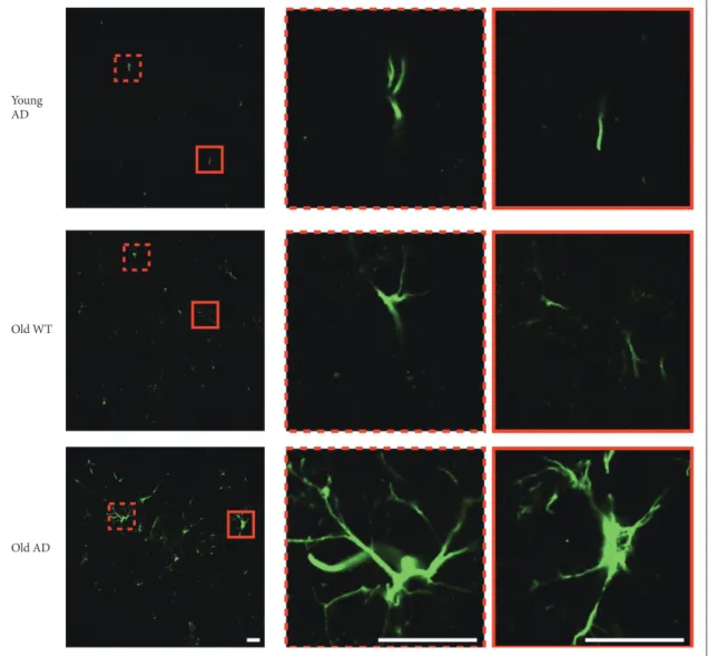 Figure 7. Morphology of activated astrocyte in long-term OHSC from old 3xTg-AD mice. Morphological difference of astrocytes according 