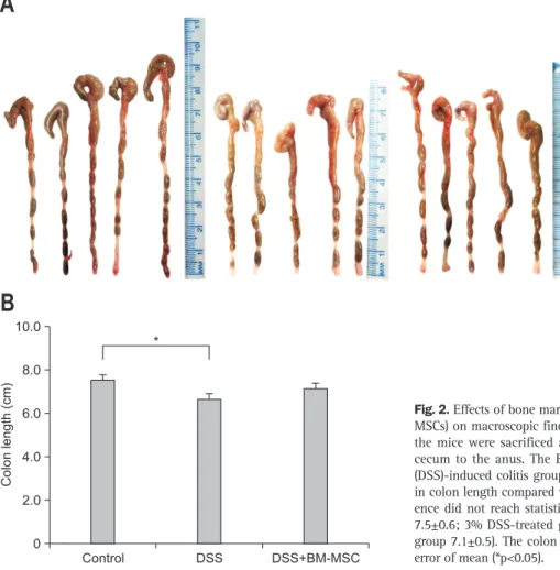 Fig. 2. Effects of bone marrow-derived mesenchymal stem cells (BM- (BM-MSCs) on macroscopic findings (A) and colon length (B)