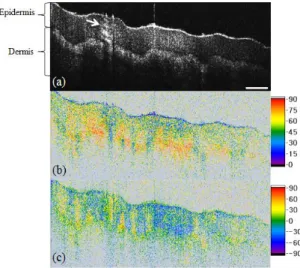 Fig.  7.  In-vivo  PS-OCT  scans  of  human  palm.  The  white  arrow  represents  the  sweat  duct  of  human palm