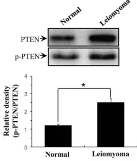 Figure 2. Western blot analysis for p-PTEN content of human uterine leio- leio-myoma and the adjacent normal myometrial tissues