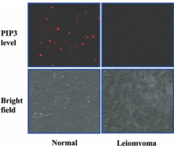 Figure 4. Western blot analysis for PPAR Á content of human uterine leio- leio-myoma and the adjacent normal myometrial tissues