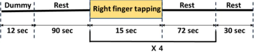 Fig. 5. Block paradigm of RFT experiment.